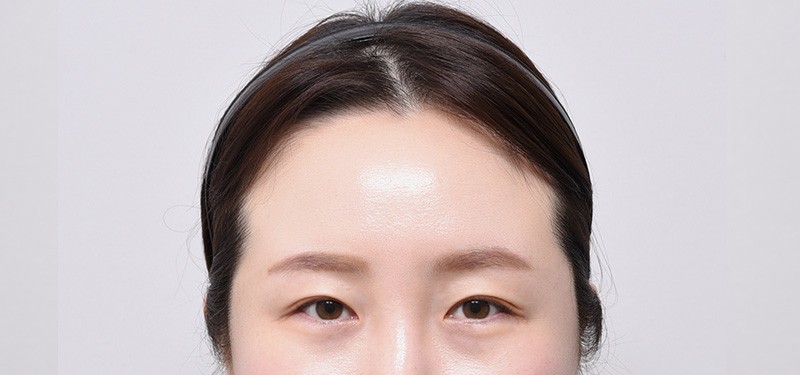 이마