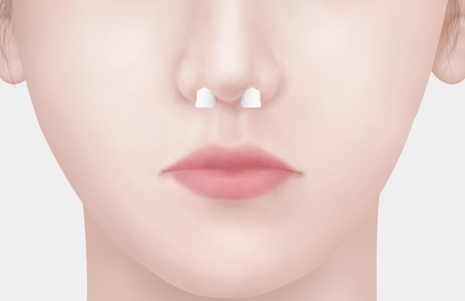 비앤영 코젤코