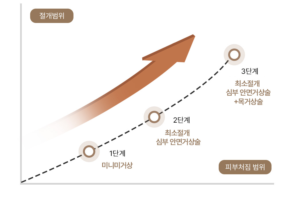 안면거상술