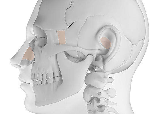Type-Specific Rhinoplasty 