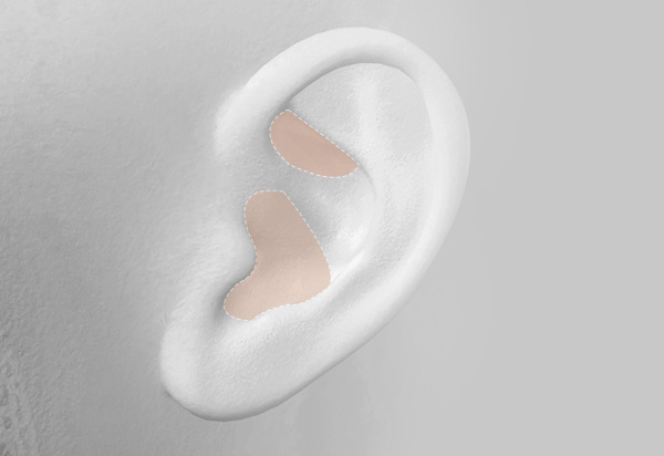 Type-Specific Rhinoplasty