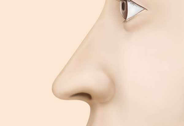 Type-Specific Rhinoplasty