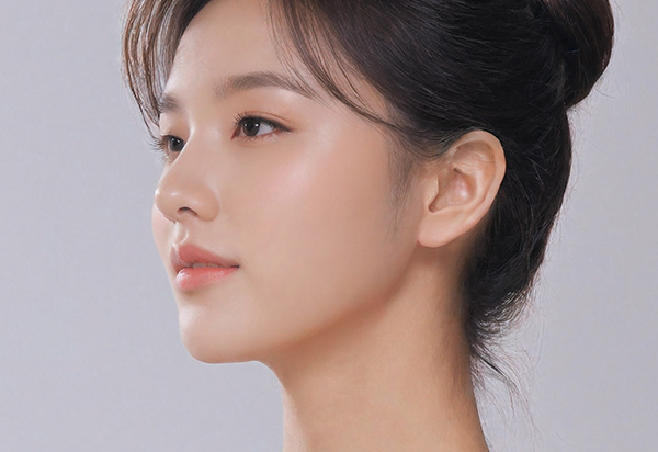 코 재수술